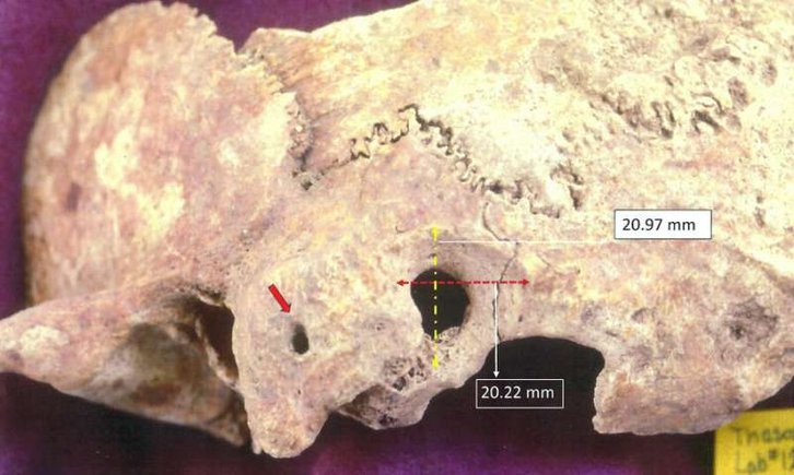 Фото: Anagnostis P. Agelarakis / Adelphi University