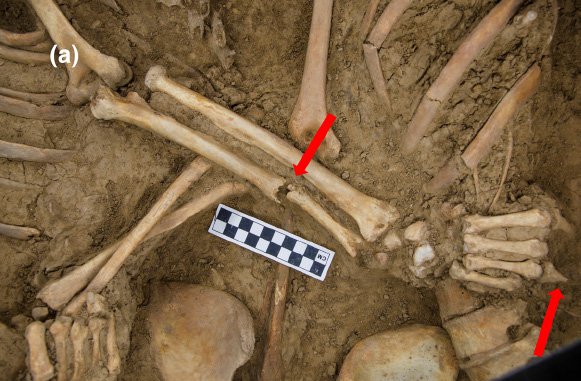 Фото: Qian Wang/International Journal of Osteoarchaeology