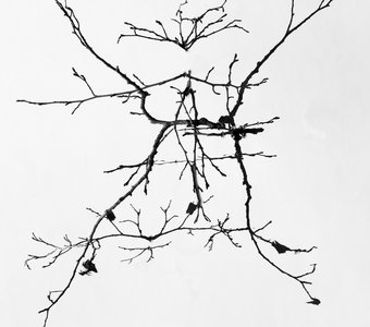 Нервная система жужулицы