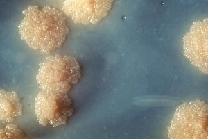 Туберкулез вернул себе звание самой смертельной инфекции, потеснив COVID-19