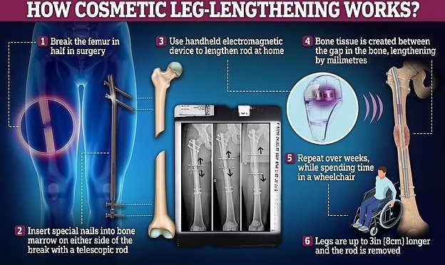 Фото: Daily Mail