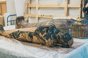 У первой в мире «беременной мумии» нашли редкую форму рака