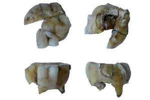 Предки американцев – сибиряки. Результаты ДНК-анализа зуба человека, умершего 14 000 лет назад