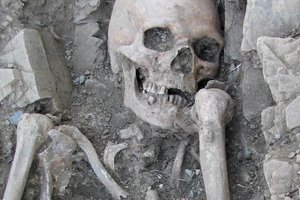 Найден древнейший скелет с генетическим заболеванием: из-за него у мужчин уменьшаются тестикулы
