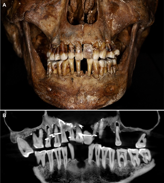 Фото: French National Institute for Preventive Archaeological Research