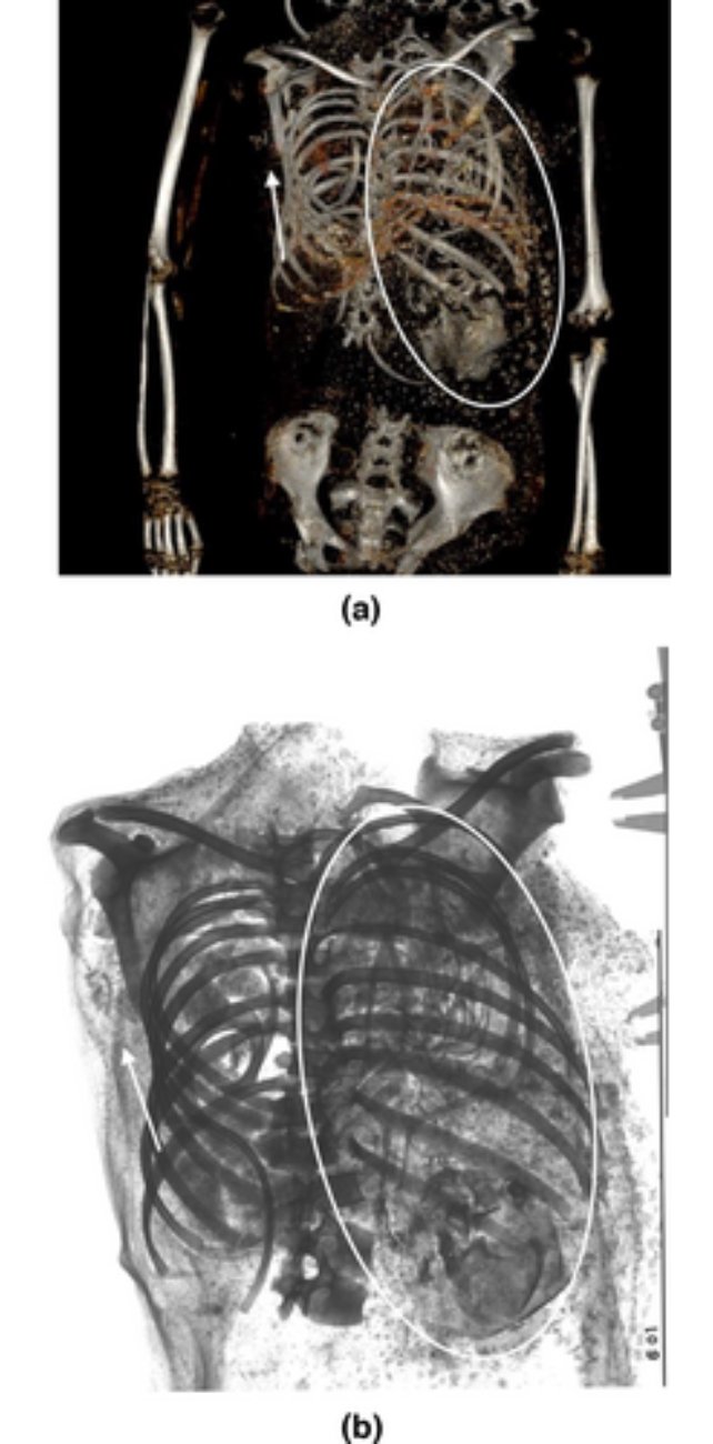 Фото: International Journal of Osteoarchaeology