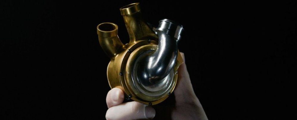 Человек прожил больше 100 дней с титановым сердцем