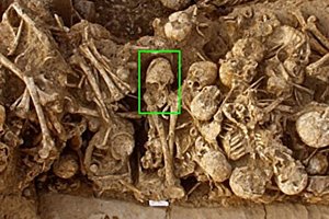 В Иране нашли древний череп девушки с искусственной деформацией