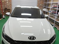 伊兰特 2022款 1.5L CVT GLX精英版