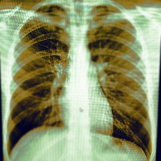 Telegram Channel logo radiologymmachat. Free Telegram Channel Analytics