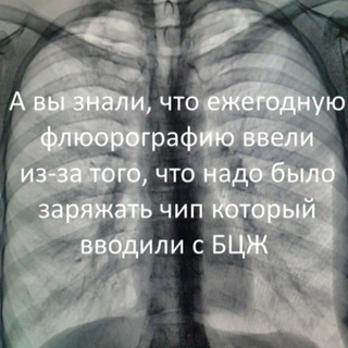 Логотип Телеграм канала Рентгенология. Бесплатная аналитика Telegram каналов