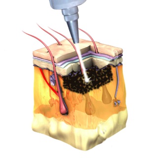Telegram Channel logo lazerudalen. Free Telegram Channel Analytics