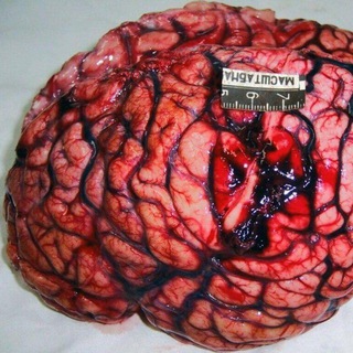 Логотип Телеграм канала . Бесплатная аналитика Telegram каналов