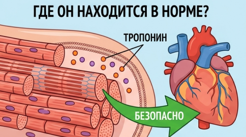 Тропонин в норме