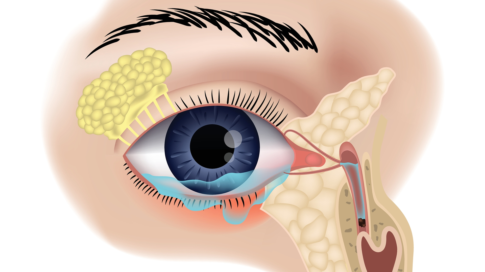 Носослезный канал открывается. Дакриоцистит осложнения конъюнктивит. Дакриоцистит воспаление слезных мешков. Слезная железа lacrimal Gland.