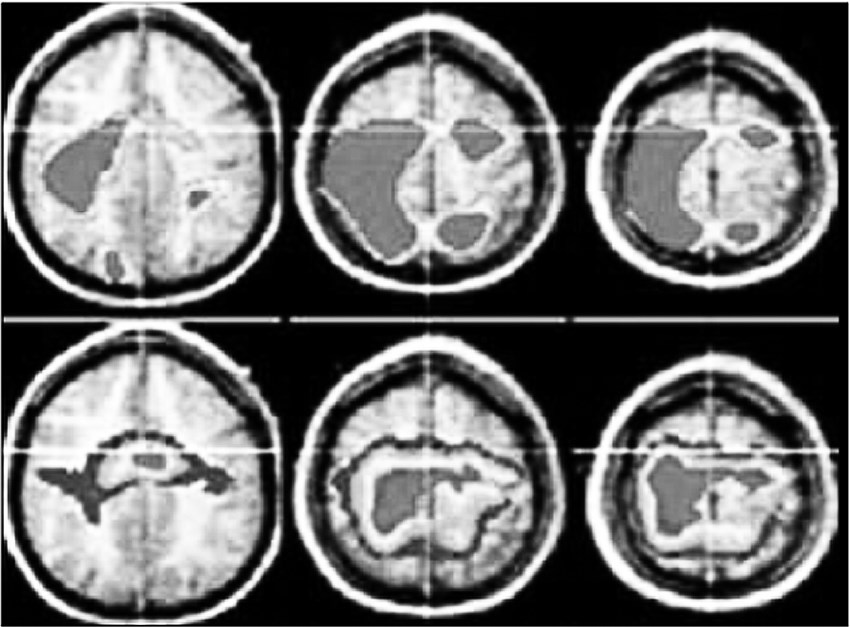 screen_image_28_301_106