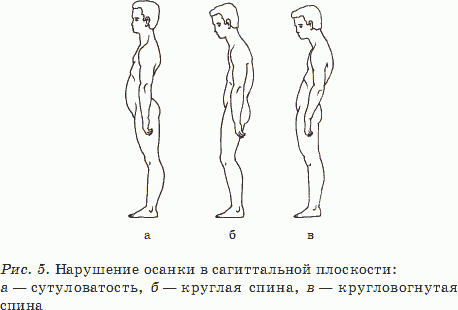 Картинки плоская спина