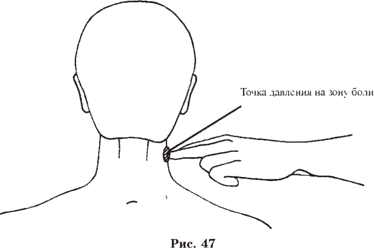 Точки надо. Точка на шее для усыпления. Болевые точки на шее. Точки для усыпания человека. Точки для усыпления человека.