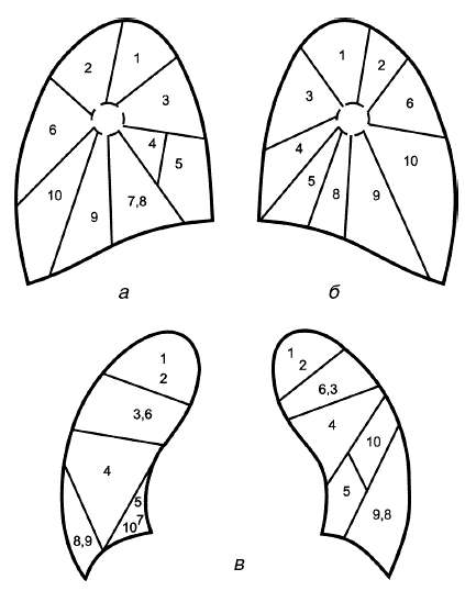 Сегментарное строение легких рентген. Сегменты легких 1-2. Сегменты легкого на кт. Сегментарное строение легких у детей.