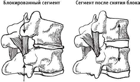 Как снять блоки позвоночника