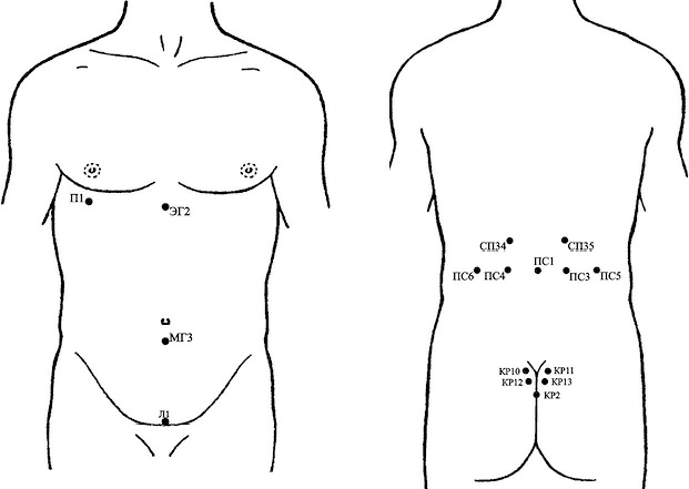 Точки куда. Пиявки на почки схема постановки. Гирудотерапия схема постановки пиявок. Точки постановки пиявок на почки. Гирудотерапия схема постановки пиявок при заболеваниях.