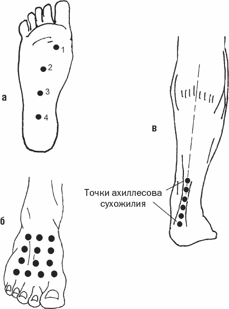 23 точки. Акупрессура стопы точки. Точечный массаж стопы точки. Точечный массаж стоп схема точек. Точечный массаж ног и ступней шиацу.