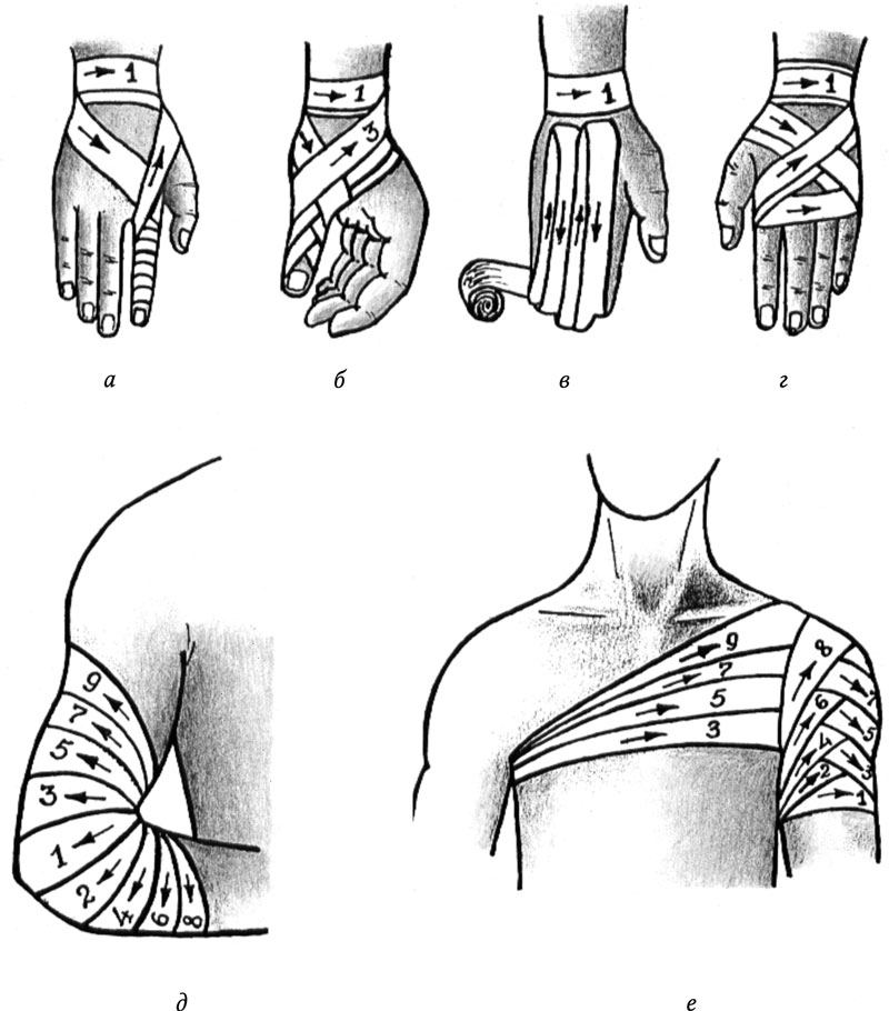 Типы бинтовых повязок рисунок