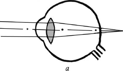 Какая из схем хода лучей в глазу человека