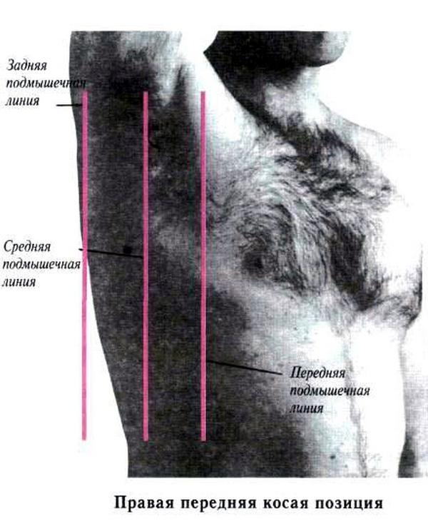 Аксиллярная область молочной железы где находится фото