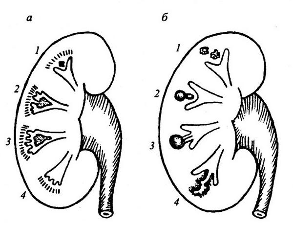 Почечная пирамида рисунок