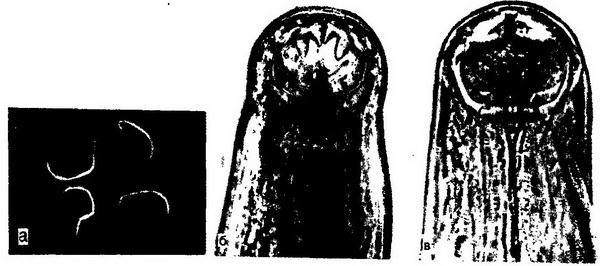 Ротовая капсула анкилостомы рисунок