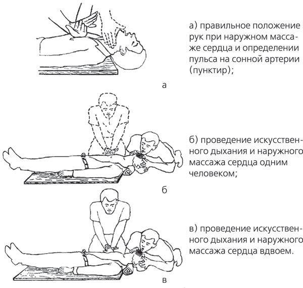 Помощь положения. Порядок проведения искусственного дыхания и непрямого массажа. Проведение искусственного дыхания и непрямого массажа сердца. Оказание первой медицинской помощи непрямой массаж сердца. Порядок непрямого массажа сердца и искусственного дыхания.