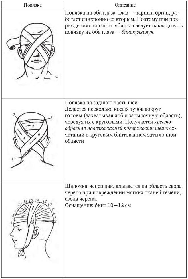 Повязки со схемой. Классификация повязок правила наложения повязок. Классификация основных видов бинтовых повязок. Десмургия классификация повязок. Типы бинтовых повязок картинки.