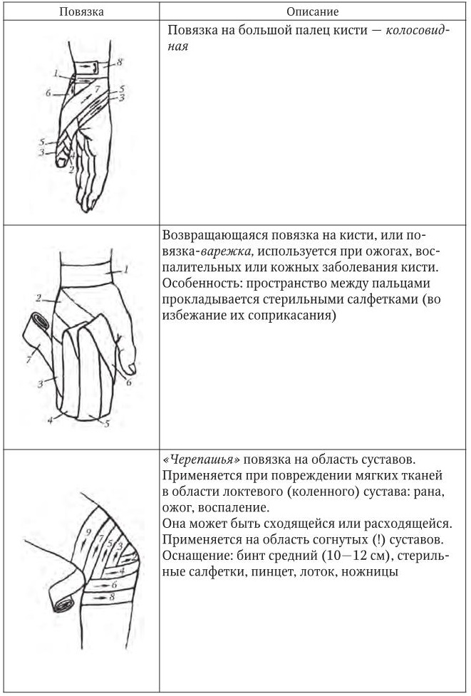 Типы бинтовых повязок рисунок