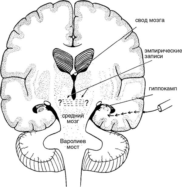 Свод головного мозга. Свод мозга анатомия. Строение свода мозга. Столбы свода мозга. Спайка свода мозга.
