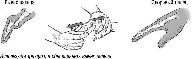 Почему опухают пальцы на руках