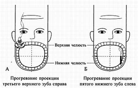 Зубная точка. Точечный массаж при боли в зубе. Точки акупрессуры при зубной боли. Точки акупунктуры при зубной боли. Акупунктурные точки при боли зуба.