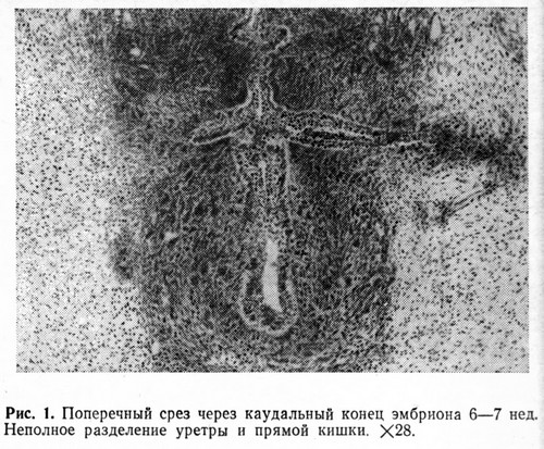 Парауретральная железа у женщин